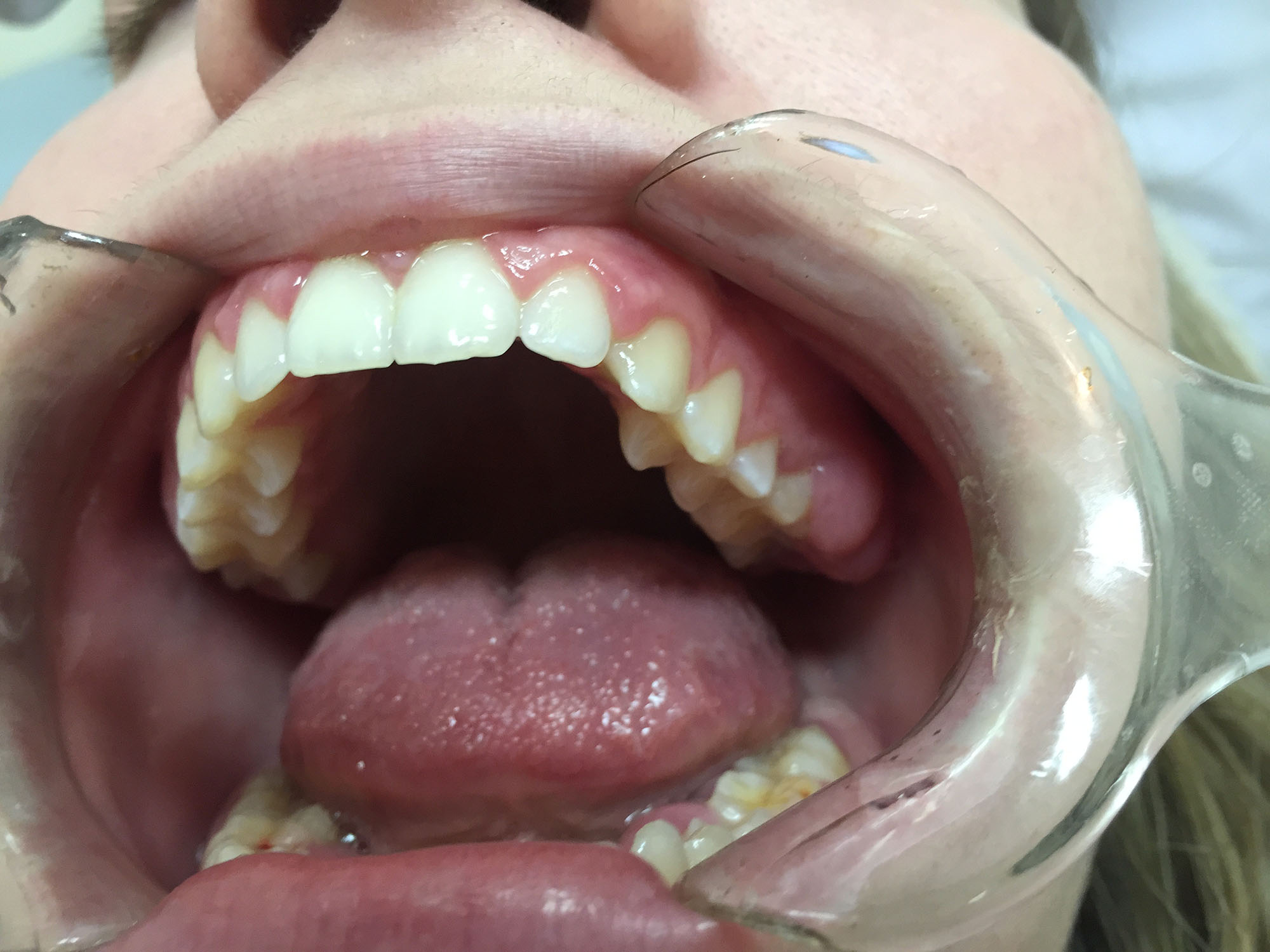 Periodontoloji - Dt. Halime Savcı, Mardin